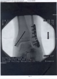 Xrayfixed.jpg