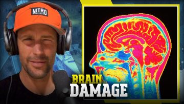 I-dont-have-brain-damage-Travis-Pastrana-talks-about-the-risks-of-CTE-and-Brain-Damage-in-Moto