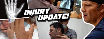 Chad-Reed-Injury-Update-Two-Week-Recovery