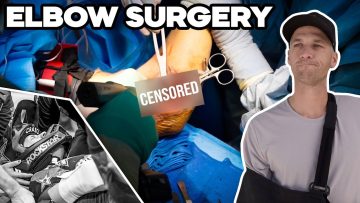 SEASON-ENDED-PART-2-Christian-Craig-Elbow-Surgery-GRAPHIC-WARNING