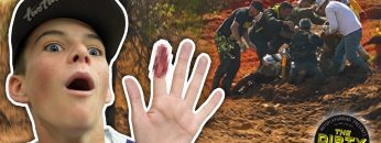 HE-ALMOST-LOST-HIS-FINGER-Hard-Lessons-at-The-Ding