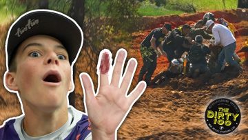 HE-ALMOST-LOST-HIS-FINGER-Hard-Lessons-at-The-Ding