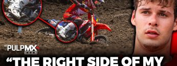 Is-Jett-Lawrences-Ankle-Getting-Better-While-Racing-on-It-Exclusive-Interview